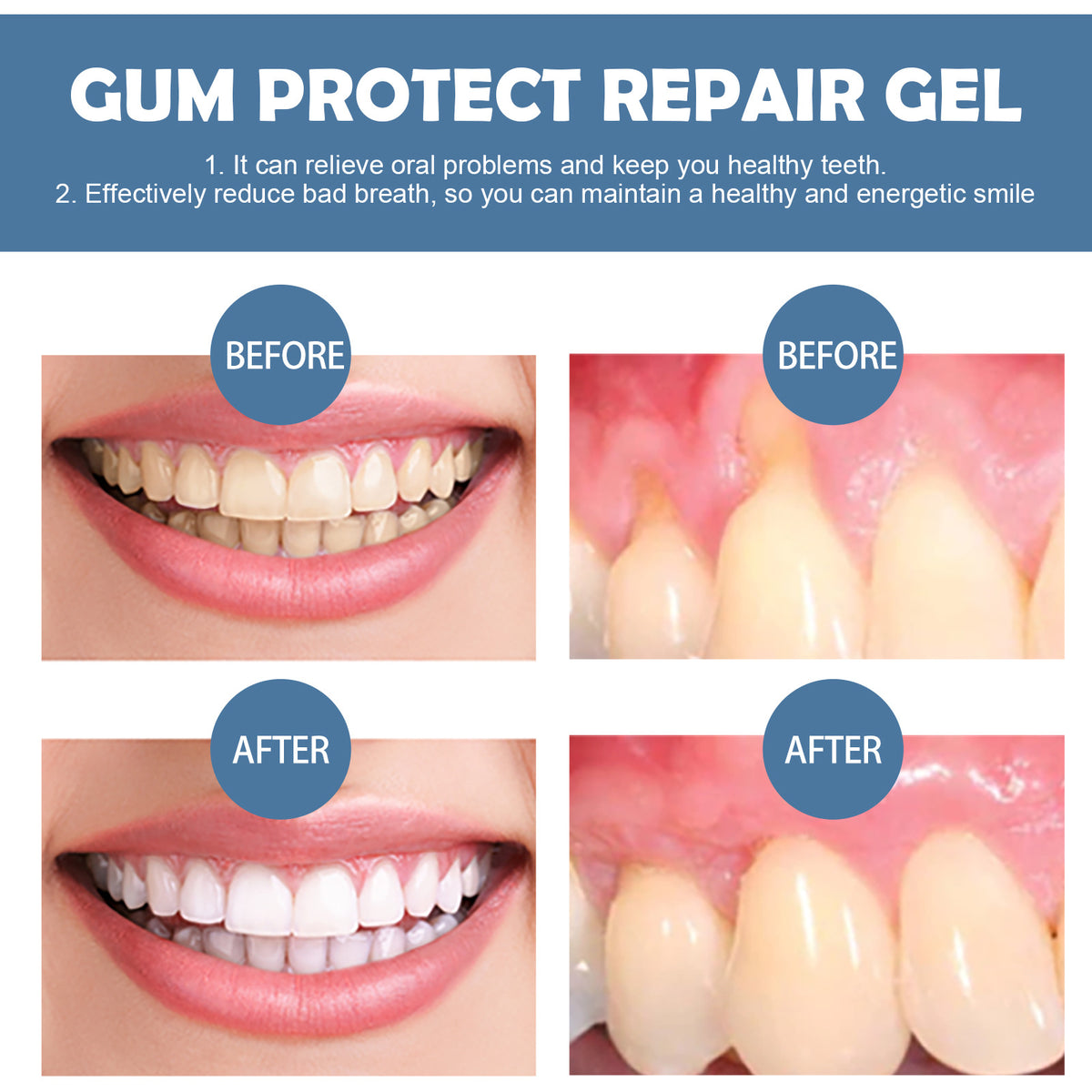 Vionwve® Gum Protect Repair Gel, Deep Clean Teeth Stains, Soothe Gum & Fresh‑Breath Oral Care Gel