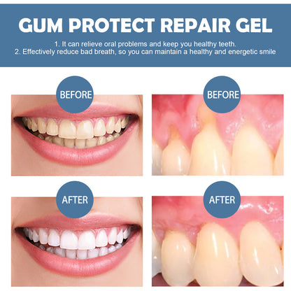 Vionwve® Gum Protect Repair Gel, Deep Clean Teeth Stains, Soothe Gum & Fresh‑Breath Oral Care Gel